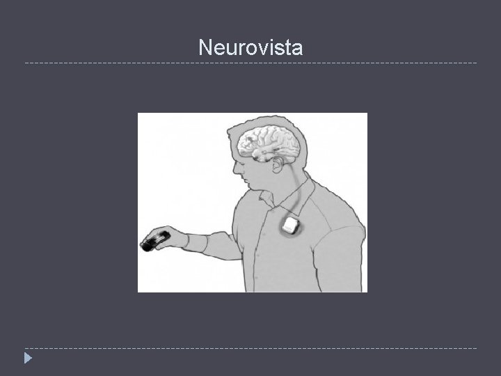 Neurovista 