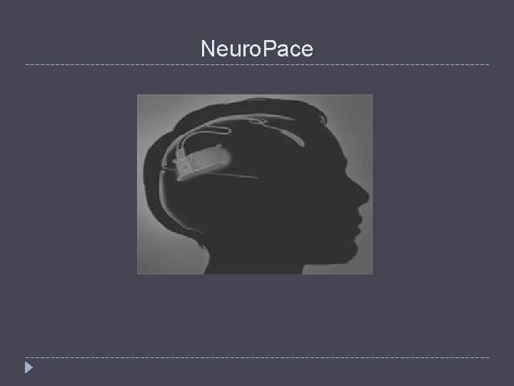 Neuro. Pace 