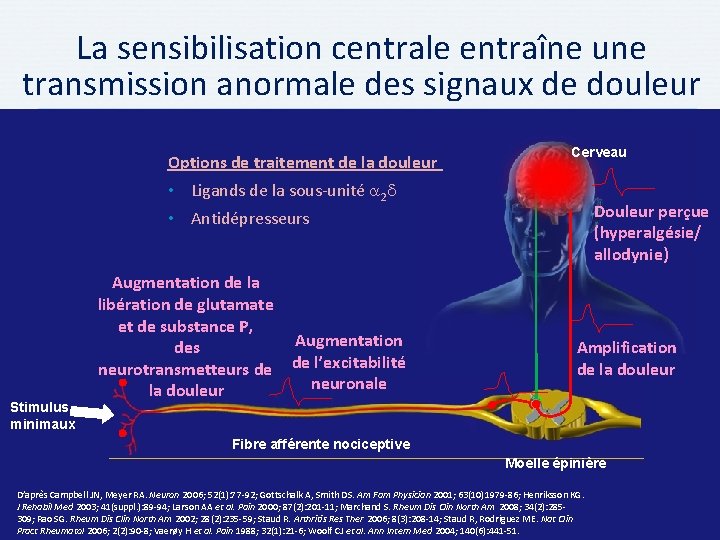 La sensibilisation centrale entraîne une transmission anormale des signaux de douleur Options de traitement