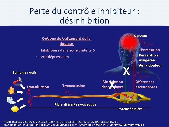Perte du contrôle inhibiteur : désinhibition Cerveau Options de traitement de la douleur •