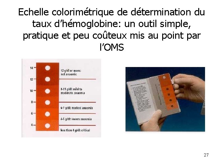 Echelle colorimétrique de détermination du taux d’hémoglobine: un outil simple, pratique et peu coûteux