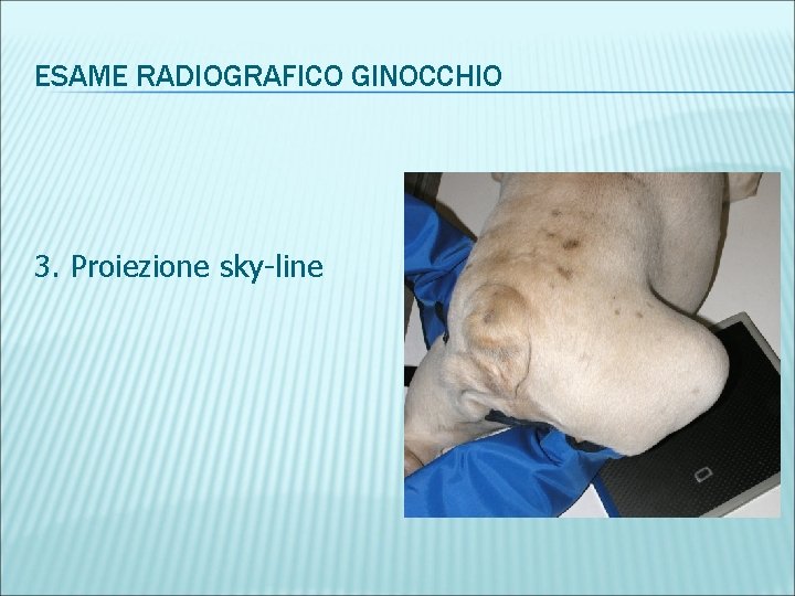 ESAME RADIOGRAFICO GINOCCHIO 3. Proiezione sky-line 