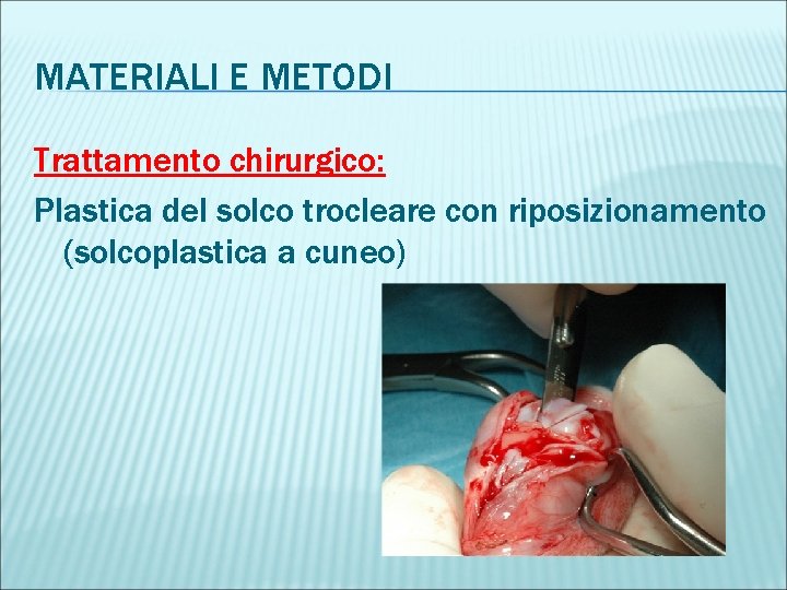MATERIALI E METODI Trattamento chirurgico: Plastica del solco trocleare con riposizionamento (solcoplastica a cuneo)