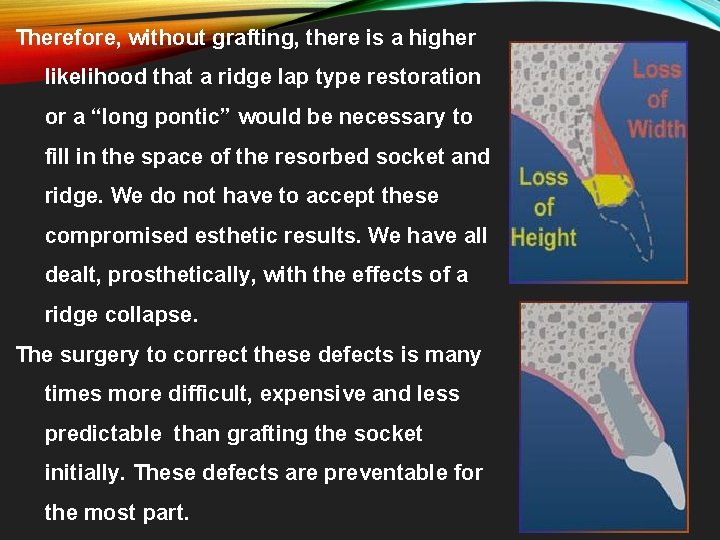 Therefore, without grafting, there is a higher likelihood that a ridge lap type restoration