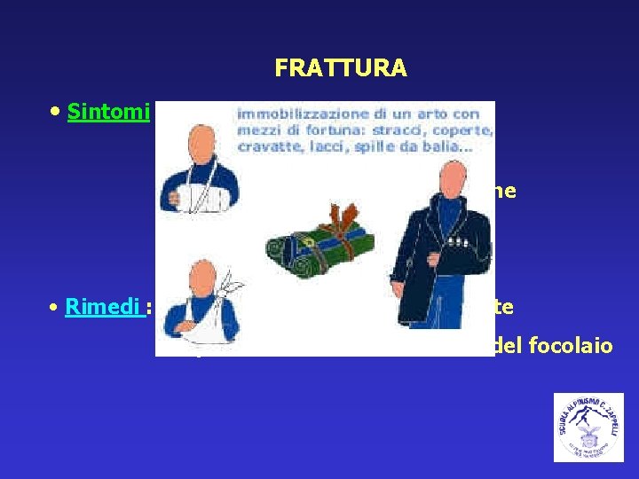 FRATTURA • Sintomi : deformità della parte gonfiore ed ematoma dolore al movimento o