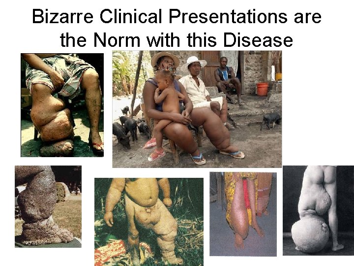Bizarre Clinical Presentations are the Norm with this Disease Bizarre Clinical Presentations are the Norm with this Disease