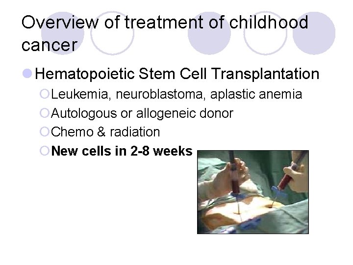 Overview of treatment of childhood cancer l Hematopoietic Stem Cell Transplantation ¡Leukemia, neuroblastoma, aplastic