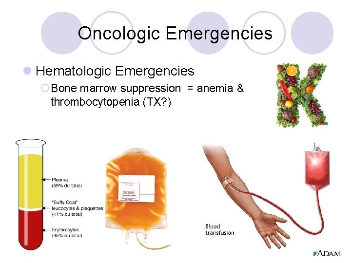 Oncologic Emergencies l Hematologic Emergencies ¡ Bone marrow suppression = anemia & thrombocytopenia (TX?