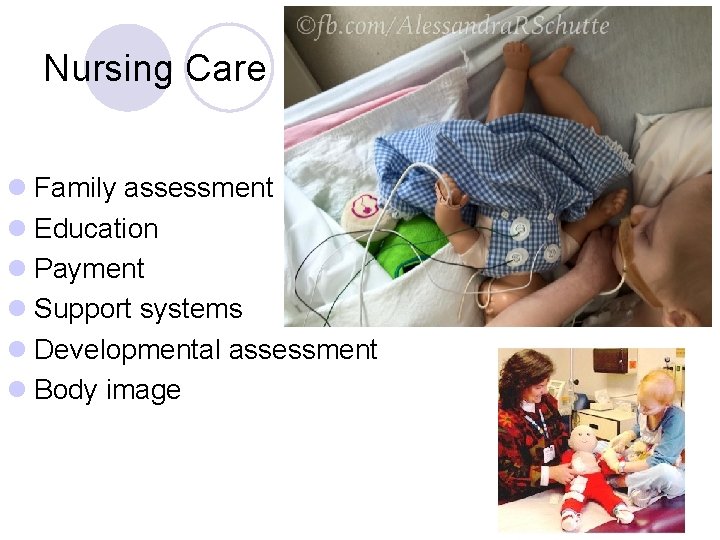 Nursing Care l Family assessment l Education l Payment l Support systems l Developmental