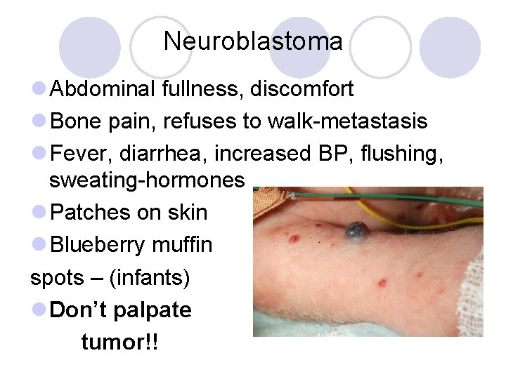 Neuroblastoma l Abdominal fullness, discomfort l Bone pain, refuses to walk-metastasis l Fever, diarrhea,