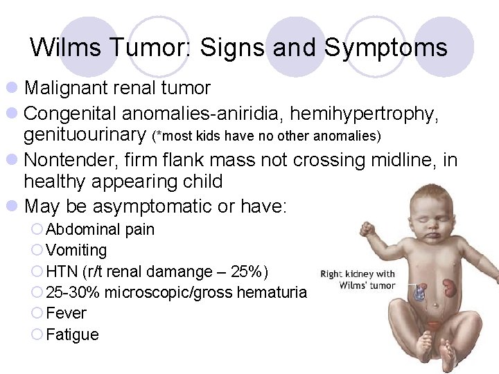 Wilms Tumor: Signs and Symptoms l Malignant renal tumor l Congenital anomalies-aniridia, hemihypertrophy, genituourinary