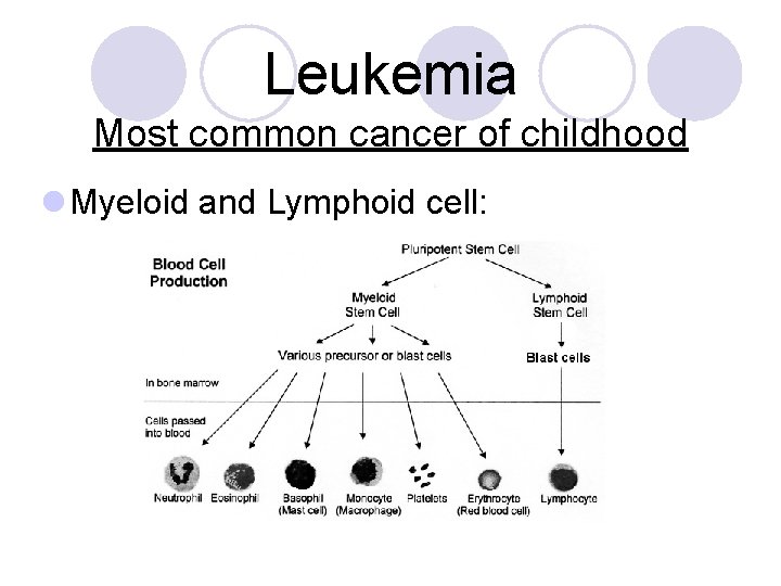 Leukemia Most common cancer of childhood l Myeloid and Lymphoid cell: 