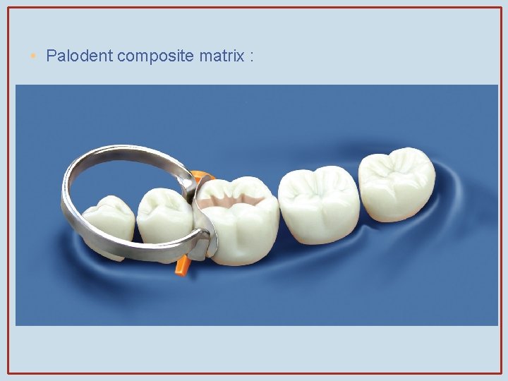  • Palodent composite matrix : 