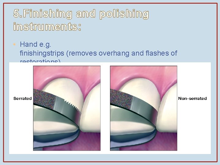 5. Finishing and polishing instruments: • Hand e. g. finishingstrips (removes overhang and flashes