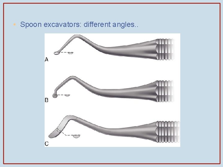  • Spoon excavators: different angles. . 
