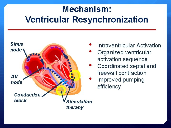 Mechanism: Ventricular Resynchronization Sinus node • • • AV node Conduction block • Stimulation