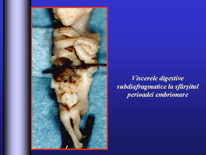 Viscerele digestive subdiafragmatice la sfârşitul perioadei embrionare 
