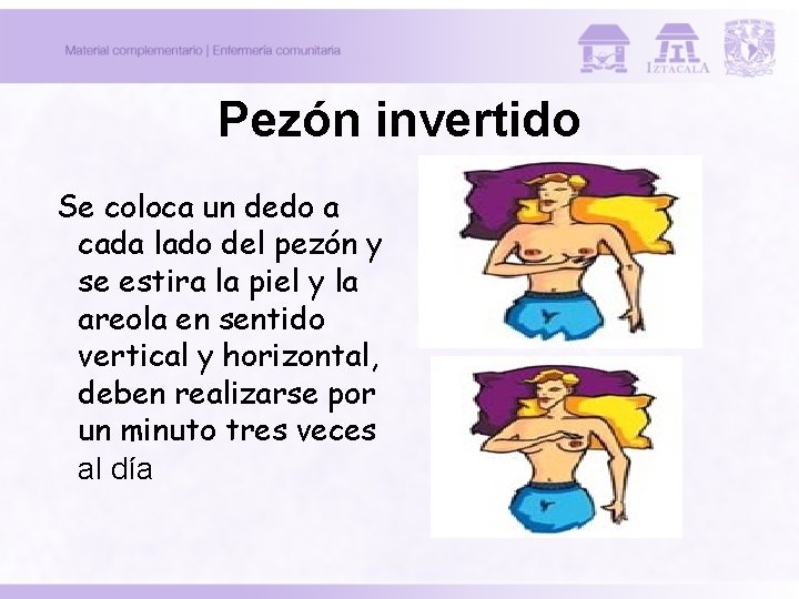 Pezón invertido Se coloca un dedo a cada lado del pezón y se estira