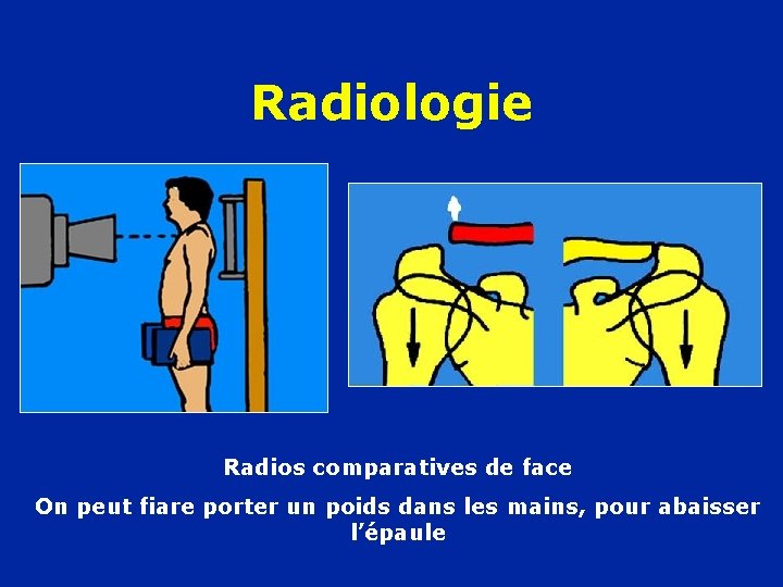 Radiologie Radios comparatives de face On peut fiare porter un poids dans les mains,