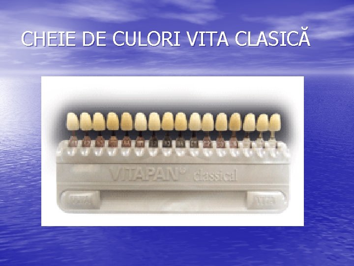 CHEIE DE CULORI VITA CLASICĂ 