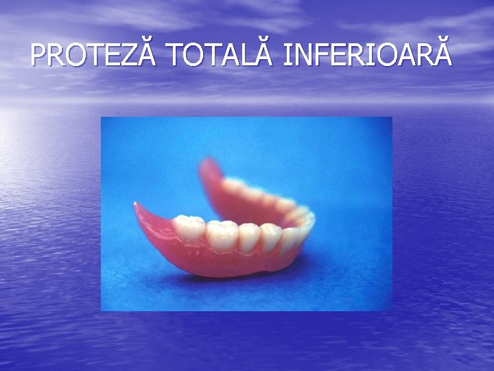 PROTEZĂ TOTALĂ INFERIOARĂ 