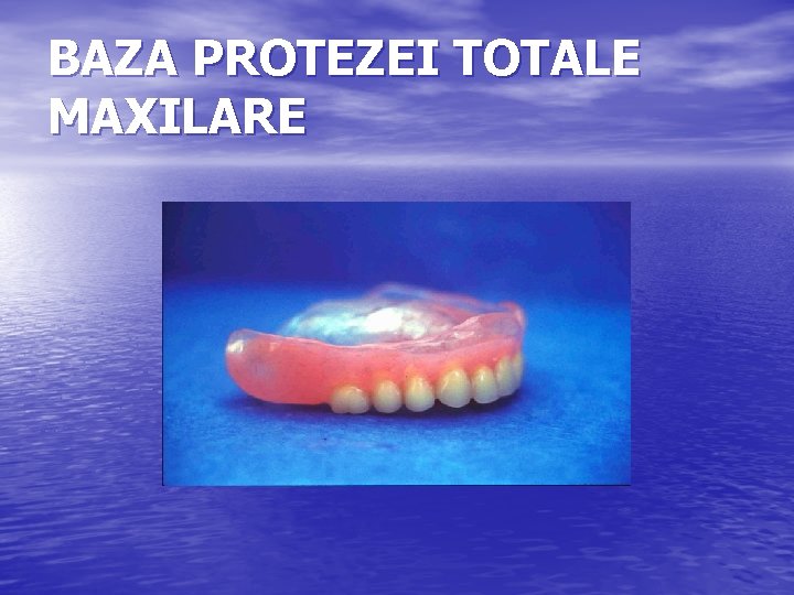 BAZA PROTEZEI TOTALE MAXILARE 