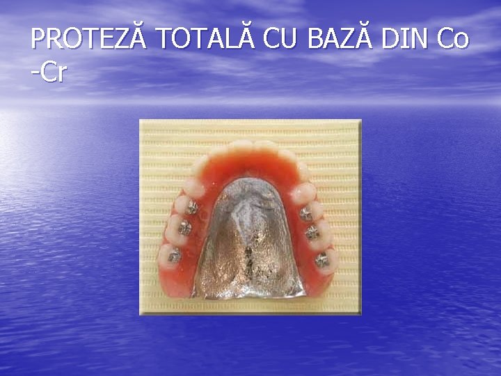 PROTEZĂ TOTALĂ CU BAZĂ DIN Co -Cr 