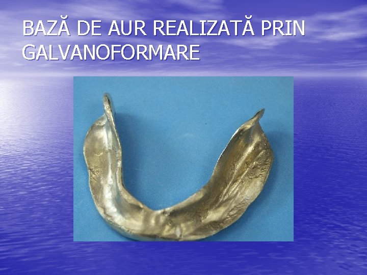 BAZĂ DE AUR REALIZATĂ PRIN GALVANOFORMARE 