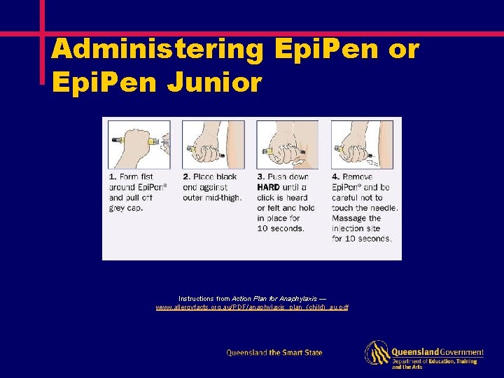 Administering Epi. Pen or Epi. Pen Junior Instructions from Action Plan for Anaphylaxis —