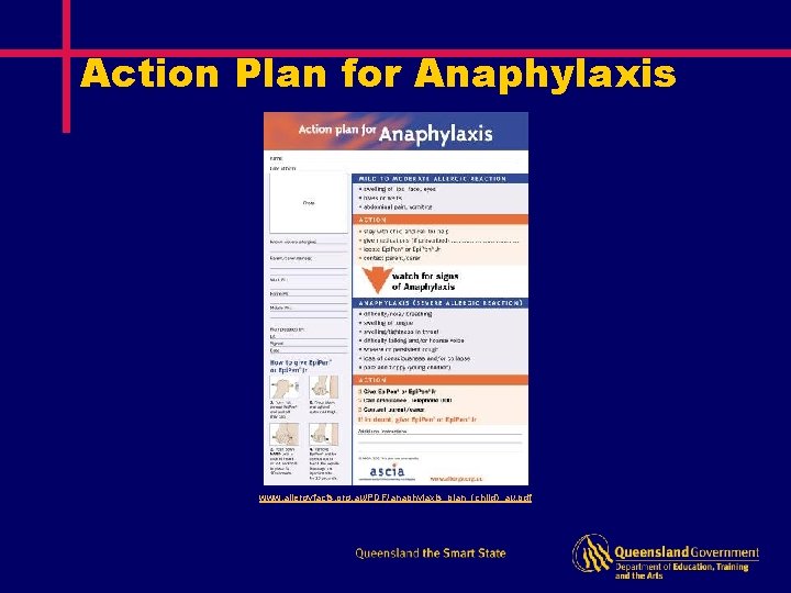 Action Plan for Anaphylaxis www. allergyfacts. org. au/PDF/anaphylaxis_plan_(child)_au. pdf 