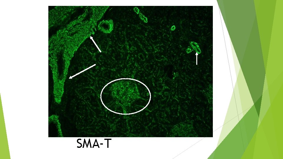 SMA-T 