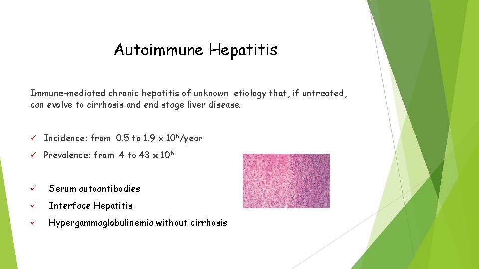 Autoimmune Hepatitis Immune-mediated chronic hepatitis of unknown etiology that, if untreated, can evolve to