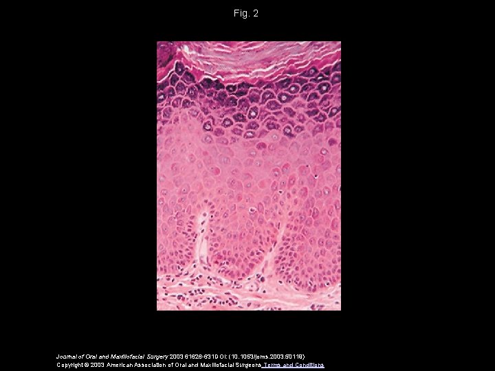 Fig. 2 Journal of Oral and Maxillofacial Surgery 2003 61626 -631 DOI: (10. 1053/joms.