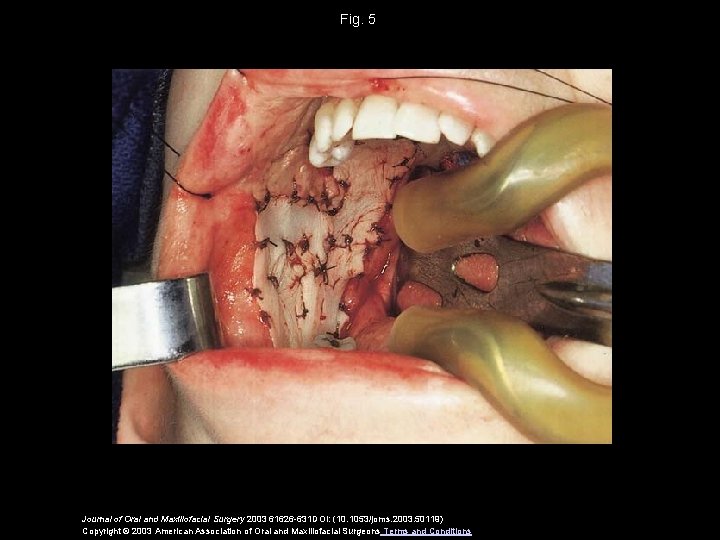 Fig. 5 Journal of Oral and Maxillofacial Surgery 2003 61626 -631 DOI: (10. 1053/joms.