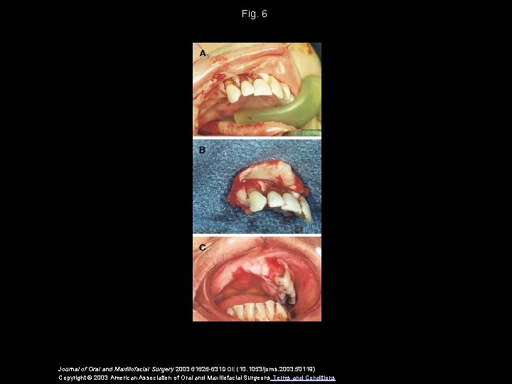 Fig. 6 Journal of Oral and Maxillofacial Surgery 2003 61626 -631 DOI: (10. 1053/joms.