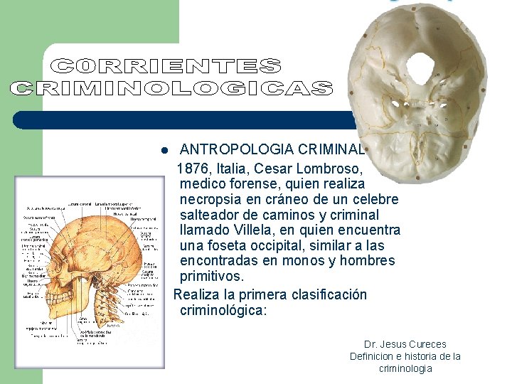 ANTROPOLOGIA CRIMINAL: 1876, Italia, Cesar Lombroso, medico forense, quien realiza necropsia en cráneo de ANTROPOLOGIA CRIMINAL: 1876, Italia, Cesar Lombroso, medico forense, quien realiza necropsia en cráneo de