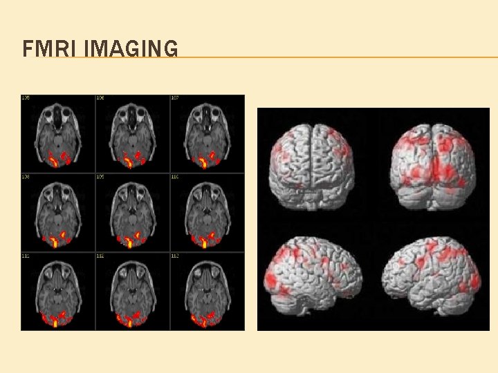 FMRI IMAGING FMRI IMAGING