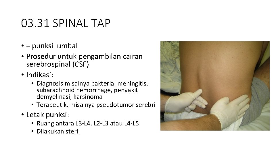 03. 31 SPINAL TAP • = punksi lumbal • Prosedur untuk pengambilan cairan serebrospinal