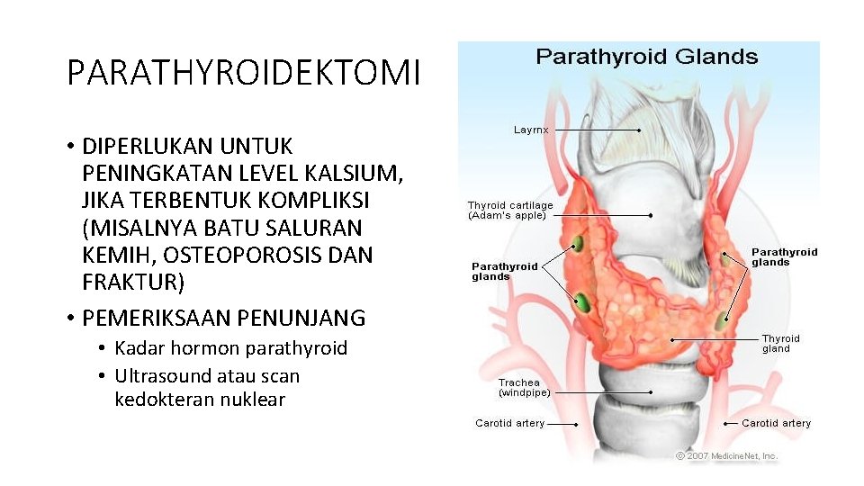 PARATHYROIDEKTOMI • DIPERLUKAN UNTUK PENINGKATAN LEVEL KALSIUM, JIKA TERBENTUK KOMPLIKSI (MISALNYA BATU SALURAN KEMIH,