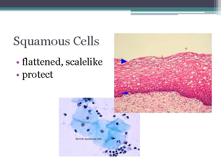 Squamous Cells • flattened, scalelike • protect 