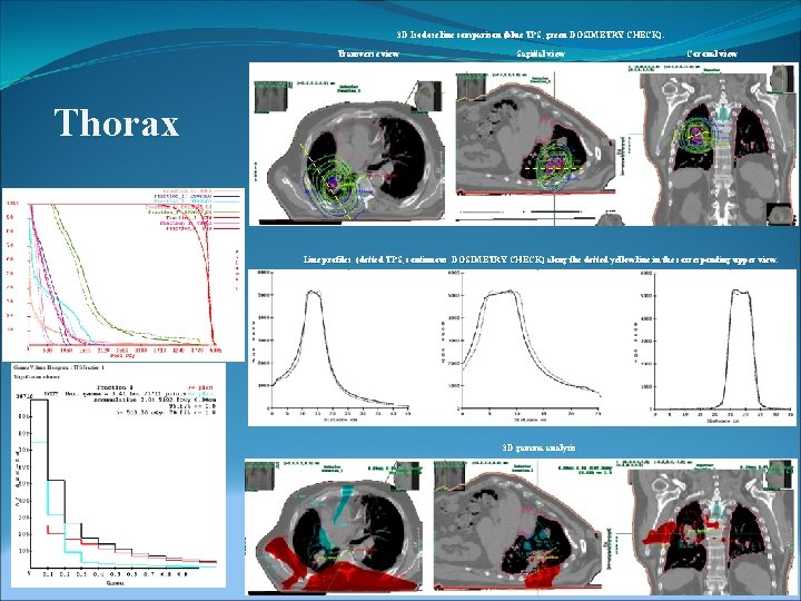 3 D Isodose line comparison (blue TPS, green DOSIMETRY CHECK). Transverse view Sagittal view