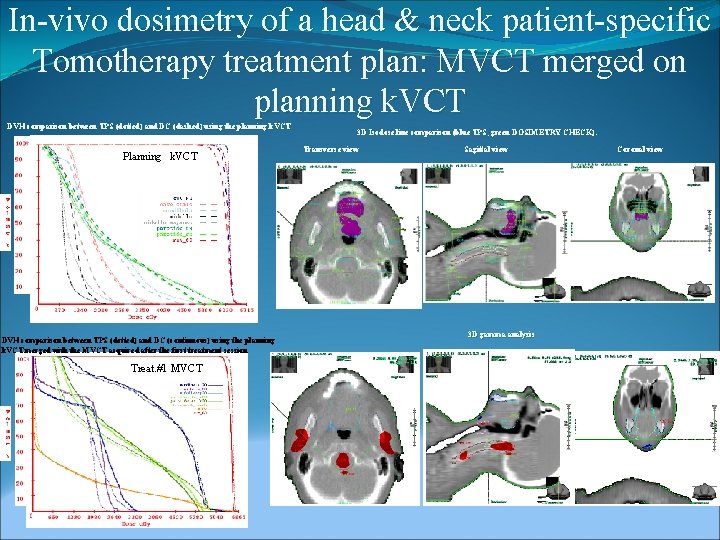 In-vivo dosimetry of a head & neck patient-specific Tomotherapy treatment plan: MVCT merged on