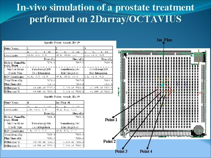 In-vivo simulation of a prostate treatment performed on 2 Darray/OCTAVIUS Iso_Plan Point 1 Point