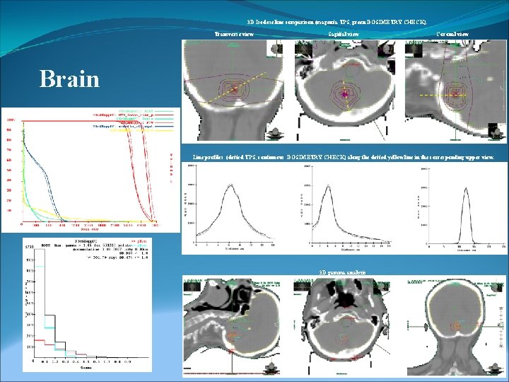 3 D Isodose line comparison (magenta TPS, green DOSIMETRY CHECK). Transverse view Sagittal view