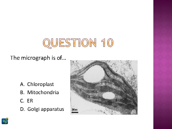 The micrograph is of… A. B. C. D. Chloroplast Mitochondria ER Golgi apparatus 