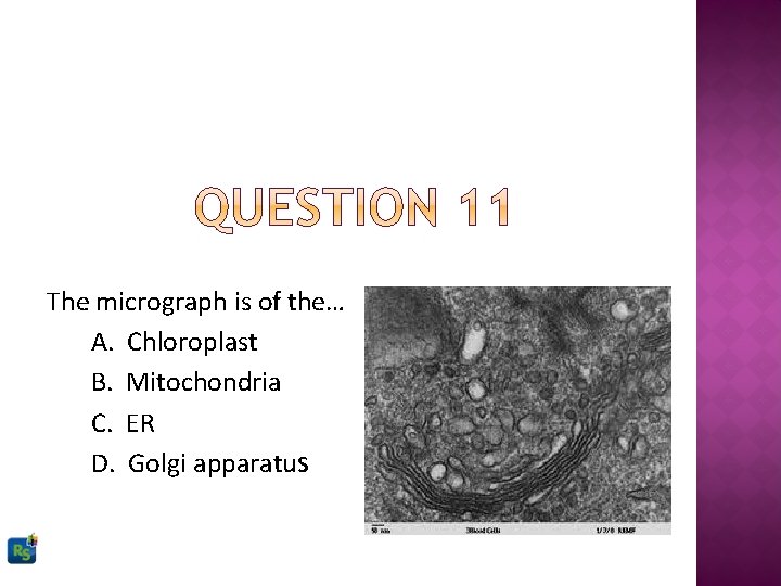 The micrograph is of the… A. Chloroplast B. Mitochondria C. ER D. Golgi apparatus