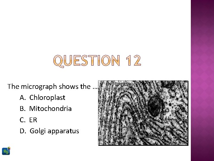 The micrograph shows the … A. Chloroplast B. Mitochondria C. ER D. Golgi apparatus