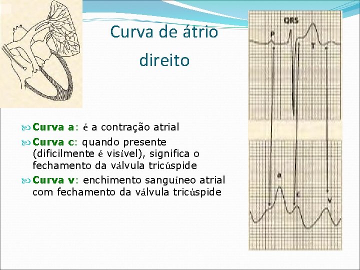 Curva de átrio direito Curva a: é a contração atrial Curva c: quando presente