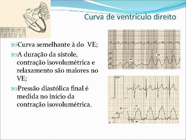 Curva de ventrículo direito Curva semelhante à do VE; A duração da sístole, contração