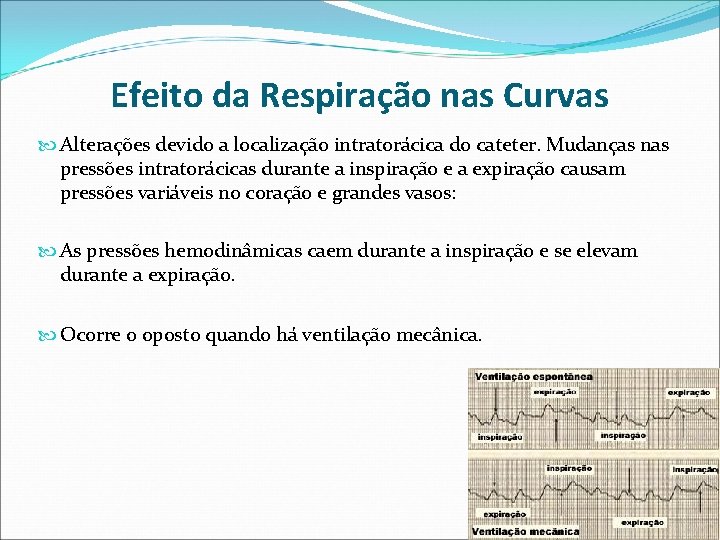 Efeito da Respiração nas Curvas Alterações devido a localização intratorácica do cateter. Mudanças nas